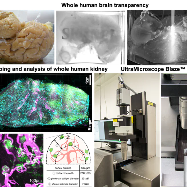 Cellular and Molecular Probing of Intact Human Organs