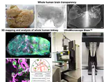 Cellular and Molecular Probing of Intact Human Organs