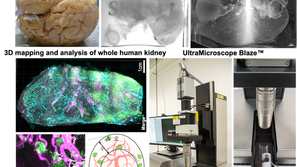 Cellular and Molecular Probing of Intact Human Organs